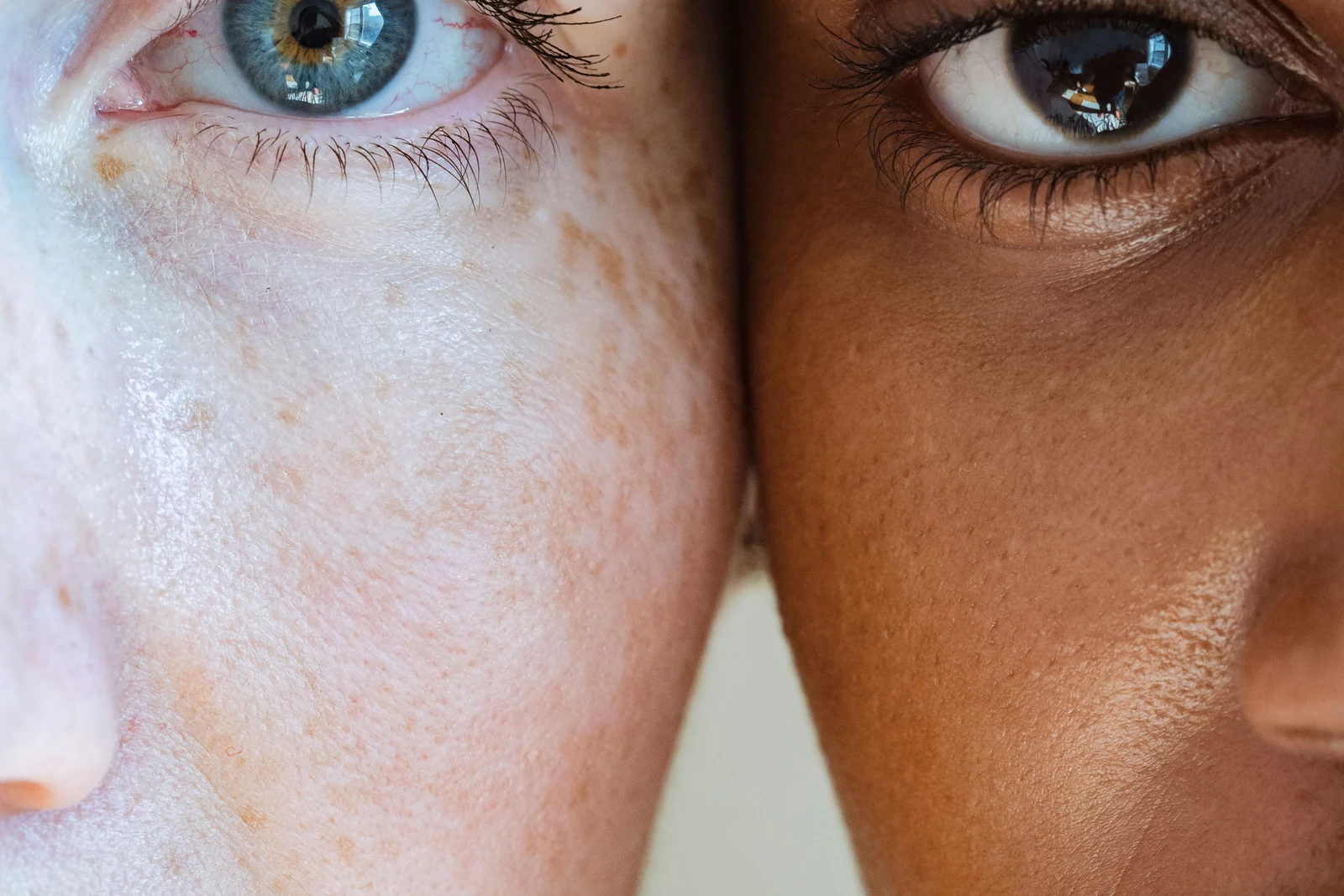 Two faces side by side in close-up, one fair and freckled, one deeper-toned, eyes to camera